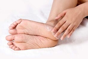 kezelése láb bőr gomba krém