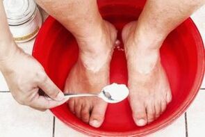 A szódával és kátrányos szappannal végzett fürdő megszünteti a gombát a lábakon